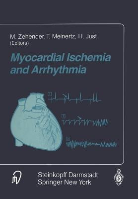 Myocardial Ischemia and Arrhythmia(English, Paperback, unknown)