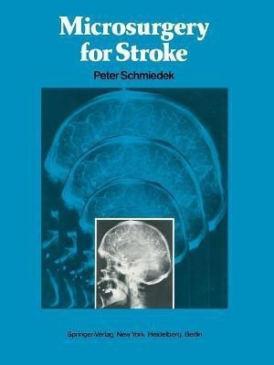 Microsurgery for Stroke(English, Paperback, unknown)