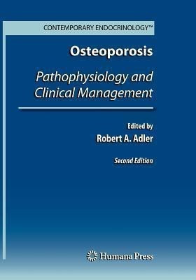 Osteoporosis(English, Paperback, unknown)