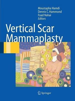 Vertical Scar Mammaplasty(English, Paperback, unknown)