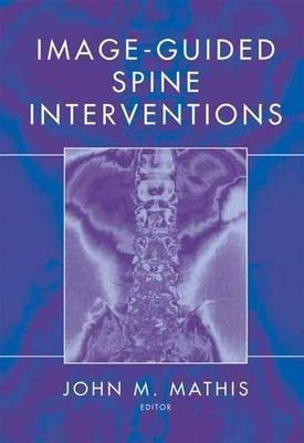 Image-Guided Spine Interventions(English, Electronic book text, unknown)