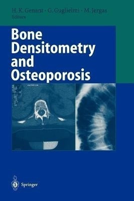 Bone Densitometry and Osteoporosis(English, Paperback, unknown)