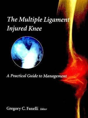 The Multiple Ligament Injured Knee(English, Hardcover, Fanelli G.C.)