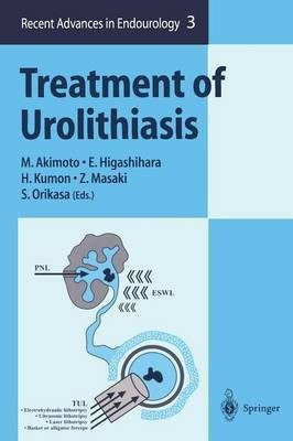 Treatment of Urolithiasis(English, Paperback, unknown)