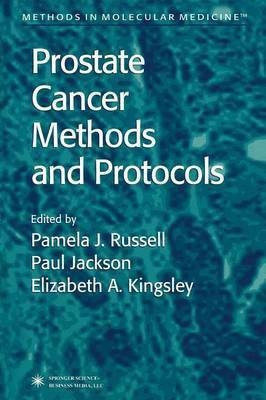 Prostate Cancer Methods and Protocols(English, Paperback, unknown)