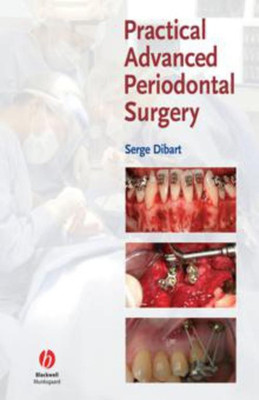 Practical Advanced Periodontal Surgery(English, Hardcover, Dibart Serge)