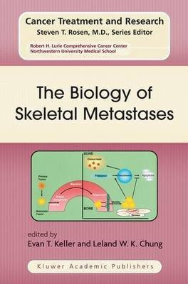 The Biology of Skeletal Metastases(English, Hardcover, unknown)