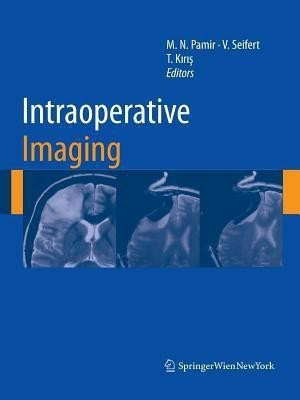 Intraoperative Imaging(English, Paperback, unknown)
