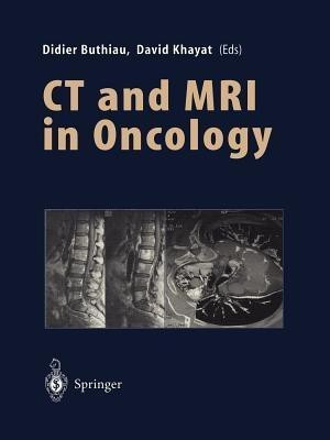 CT and MRI in Oncology(English, Paperback, unknown)