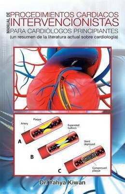 Manual de procedimientos cardiacos intervencionistas para cardiologos principiantes(Spanish, Paperback, Kiwan Yahya Dr)