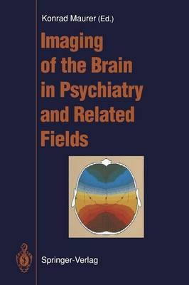 Imaging of the Brain in Psychiatry and Related Fields(English, Paperback, unknown)