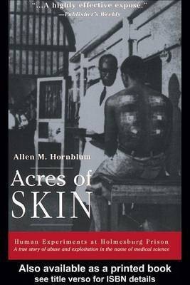 Acres of Skin(English, Electronic book text, Hornblum Allen M)