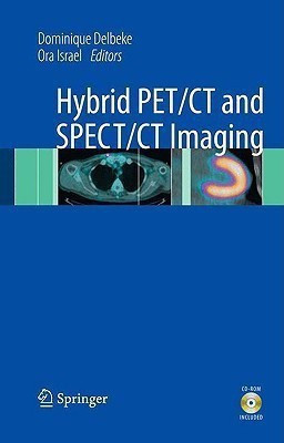 Hybrid PET/CT and SPECT/CT Imaging(English, Mixed media product, unknown)