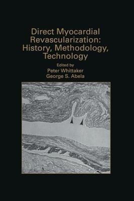 Direct Myocardial Revascularization: History, Methodology, Technology(English, Paperback, unknown)