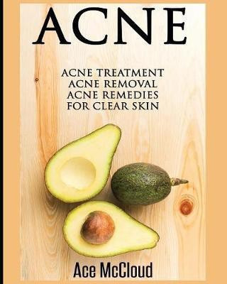 Acne(English, Paperback, McCloud Ace)