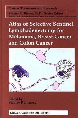 Atlas of Selective Sentinel Lymphadenectomy for Melanoma, Breast Cancer and Colon Cancer(English, Hardcover, unknown)