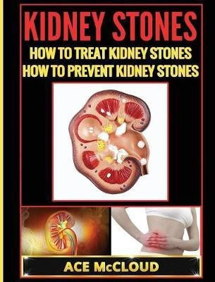 Kidney Stones(English, Hardcover, McCloud Ace)
