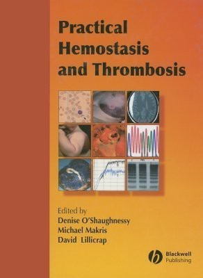 Practical Hemostasis and Thrombosis(English, Hardcover, O'Shaughnessy D)