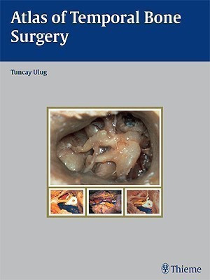 Atlas of Temporal Bone Surgery(English, Hardcover, Ulug Tuncay)