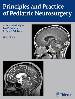 Principles and Practice of Pediatric Neurosurgery(English, Hardcover, Albright A. Leland)