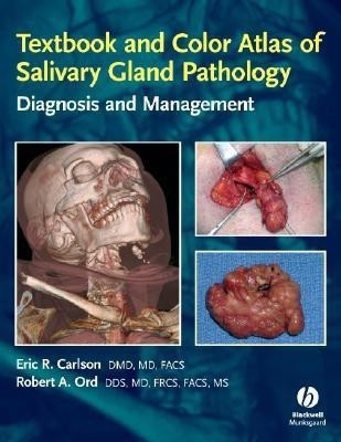 Textbook and Color Atlas of Salivary Gland Pathology(English, Hardcover, Carlson Eric R.)