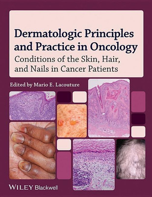 Dermatologic Principles and Practice in Oncology(English, Hardcover, Lacouture Mario E.)