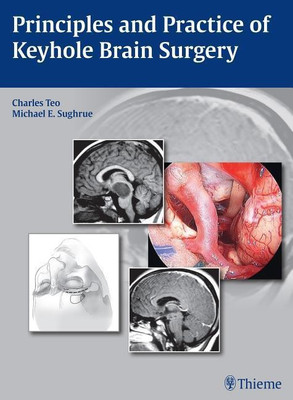 Principles and Practice of Keyhole Brain Surgery(English, Hardcover, Teo Charles)