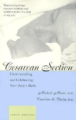 Cesarean Section(English, Paperback, Moore Michele C. M.D.)