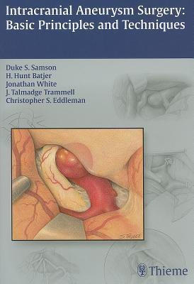 Intracranial Aneurysm Surgery(English, Paperback, unknown)