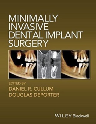 Minimally Invasive Dental Implant Surgery(English, Hardcover, unknown)