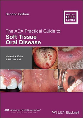 The ADA Practical Guide to Soft Tissue Oral Disease(English, Paperback, Kahn Michael A.)