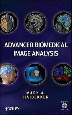 Advanced Biomedical Image Analysis(English, Hardcover, Haidekker Mark)