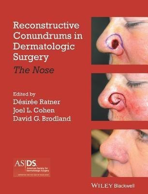Reconstructive Conundrums in Dermatologic Surgery(English, Hardcover, unknown)