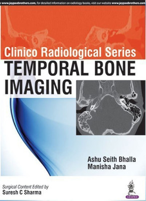 Clinico Radiological Series: Temporal Bone Imaging(English, Paperback, Bhalla Ashu Seith)