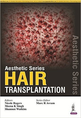 Aesthetic Series - Hair Transplantation(English, Hardcover, unknown)