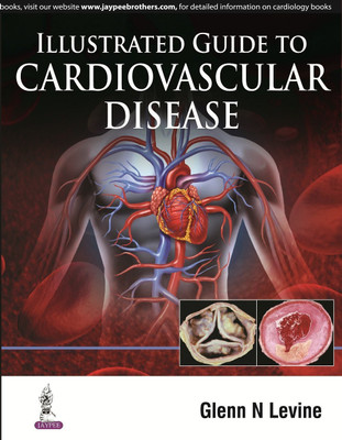 Illustrated Guide to Cardiovascular Disease(English, Hardcover, Levine Glenn N)