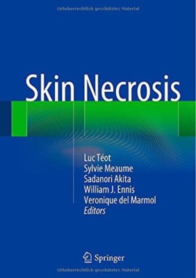 Skin Necrosis(English, Hardcover, unknown)