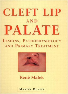 Cleft Lip and Palate(English, Hardcover, Malek Rene)