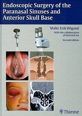 Endoscopic Surgery of the Paranasal Sinuses and Anterior Skull Base(English, Hardcover, Wigand Malte Erik)