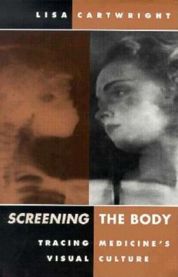 Screening the Body(English, Paperback, Cartwright Lisa)