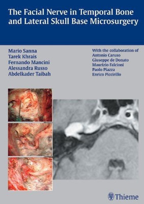 The Facial Nerve in Temporal Bone and Lateral Skull Base Microsurgery(English, Hardcover, Khrais Tarek)