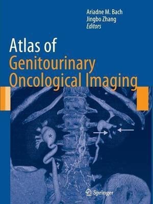 Atlas of Genitourinary Oncological Imaging(English, Paperback, unknown)