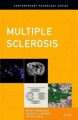 Multiple Sclerosis(English, Hardcover, Rodriguez Moses)