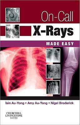 On-Call X-Rays Made Easy(English, Paperback, Au-Yong Iain)