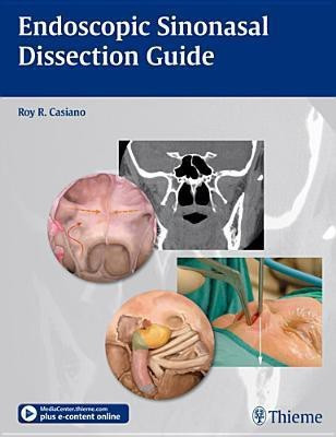 Endoscopic Sinonasal Dissection Guide 1st Edition(English, Paperback, Casiano Roy R.)