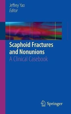 Scaphoid Fractures and Nonunions(English, Paperback, unknown)