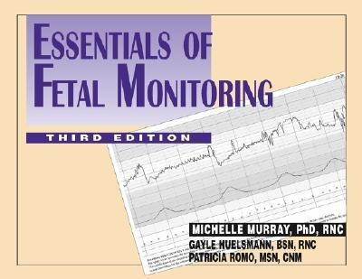 Essentials of Fetal Monitoring(English, Paperback, Murray Michelle)