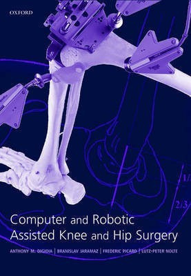 Computer and Robotic Assisted Hip and Knee Surgery 1st ed. Edition(English, Hardcover, unknown)