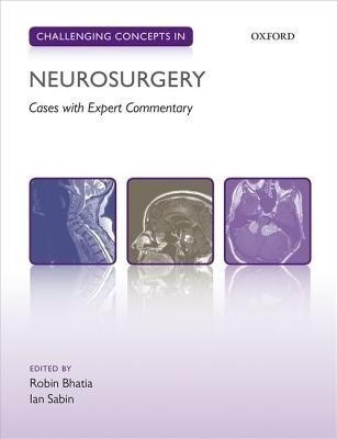 Challenging Concepts in Neurosurgery(English, Paperback, unknown)