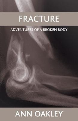 Fracture(English, Paperback, Oakley Ann)